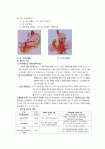 위암 4페이지