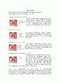 폐암과 흡연(다양한그림자료포함) 2페이지