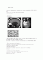 brain tumor (뇌종양)의 종류와 특징 3페이지