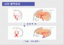 뇌혈관사고, 뇌졸중 8페이지