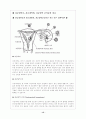 자궁내막증(모성 케이스) 15페이지