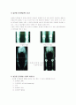 슬관절 전치환술(TKR) 5페이지