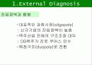 하이트와 하이트 프라임의 비교분석 / 브랜드 성공 실패 사례 11페이지