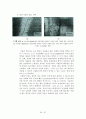 미세 조직 관찰 (al-mg alloy, cast iron) 52페이지