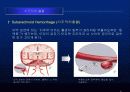 뇌졸중에 대한 발표자료 10페이지