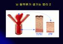 뇌 동  맥 류(Cerebral Aneurysm) 34페이지