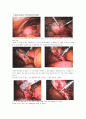 담석증 담낭절제술 수술실 케이스 15페이지