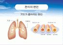 아동간호학 발표 천식(ASTHMA) 8페이지
