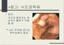 간경화증 [liver cirrhosis] -치료 식이의 지침- 11페이지