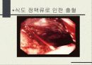 간경화증 [liver cirrhosis] -치료 식이의 지침- 12페이지