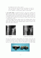 관절염 case study 6페이지