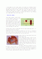 위암 케이스(Stomach Cancer case) 2페이지