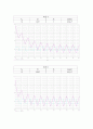 실험 미분기와 적분기 회로도 와 파형 7페이지