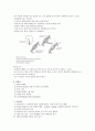 MCA infarction 4페이지