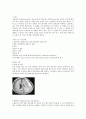 경막하혈종(CSDH) 대상자에 대한 Case study 3페이지