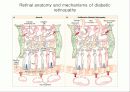 당뇨병성 망막증 (diabetic retinopathy) 14페이지