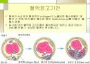 응고장해(Coagulation disorder) 3페이지