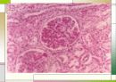 응고장해(Coagulation disorder) 24페이지