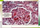 응고장해(Coagulation disorder) 26페이지