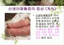 신생아 패혈증 6페이지