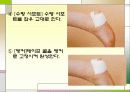 대체보완간호학 - 테이핑 요법(사진 有) 33페이지