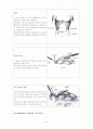 충수돌기염 문헌고찰과 케이스(간호과정) 8페이지