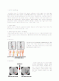 [간호학] 뇌경색 케이스 4페이지