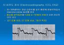 협심증환자간호 24페이지