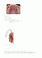 치의학-치아교정장치에 대한 레포트 5페이지