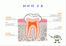 치아우식증예방법PPT 2페이지