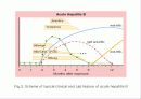 급성 바이러스성 간염 (acute viral hepatitis ) 35페이지