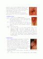 모성 성전파성질환, 비뇨기계감염, 기타 감염성 질환 레포트 2페이지