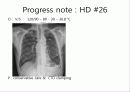 lung cancer 30페이지