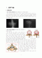 요추 척추관 협착증(Spinal stenosis of lumbar spine)case study 1페이지