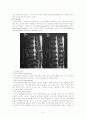 요추 척추관 협착증(Spinal stenosis of lumbar spine)case study 6페이지