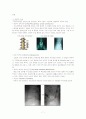 요추 척추관 협착증(Spinal stenosis of lumbar spine)case study 7페이지