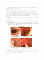 내과질환, 검사 및 간호, 튜브 및 관리, 병원 감염관리, pt care술 59페이지