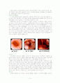 내과질환, 검사 및 간호, 튜브 및 관리, 병원 감염관리, pt care술 73페이지