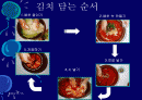 김치의 영양적 특성과 발효과정 2페이지