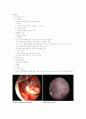 자궁근종(uterine myoma) 6페이지