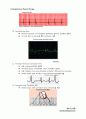 심호흡계 물리치료 (Cardiopulmonary Physical Therapy) 35페이지