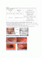 궤양성대장염 ( Ulcerative Colitis ) 2페이지