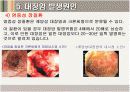 대장암  large intestine cancer 19페이지