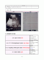 모성간호학 분만실 실습 레포트 (조기양막파수와 유도분만) 25페이지