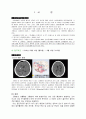 고혈압성 뇌내출혈 케이스 스터디 1페이지