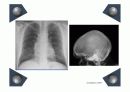 ct,mri,pet에 대해 25페이지