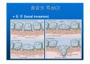 신생물(종양) 7페이지