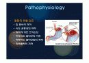 역류성 식도 질환 (GERD) 7페이지