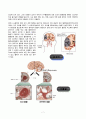 Case Study - 뇌경색 7페이지