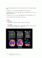 뇌혈관 조영술(Cerebral Angiography) 3페이지